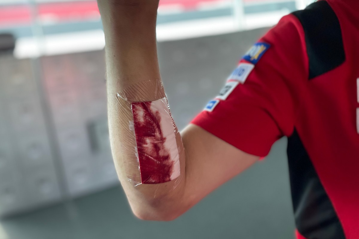 La ferita al braccio di Jack Miller riaperta dopo la caduta al Gran Premio del Portogallo di MotoGP 2021 a Portimao